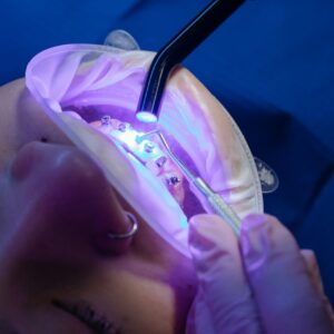 Curing Light