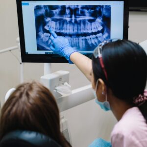 X-Ray