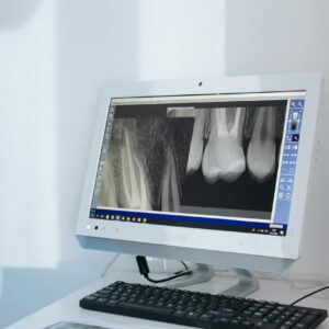 Intraoral Imaging