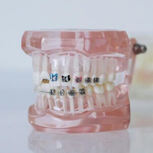 Orthodontics