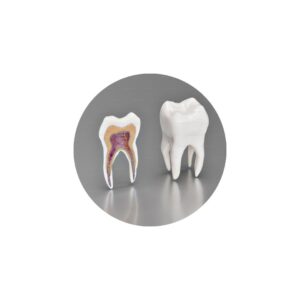 Endodontics